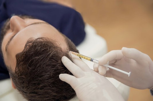 بلازما ماجلان لعلاج تساقط الشعر