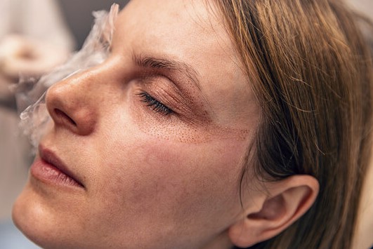 بلازما ماجلان للبشرة