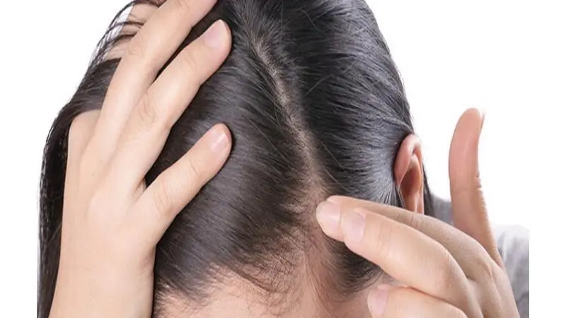 كيف تسرع من نمو الشعر