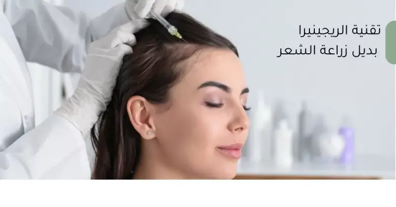 تقنية ريجينيرا بديل زراعة الشعر
