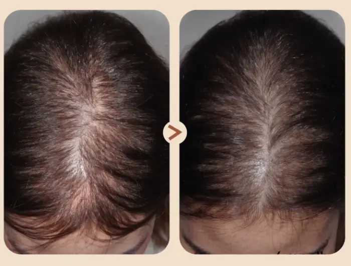 فوائد ريجينيرا للشعر