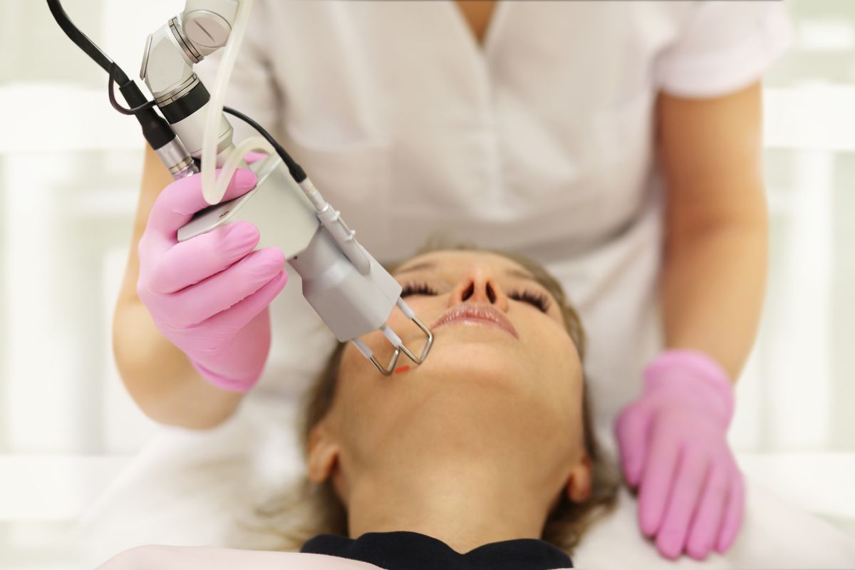Pico laser لعلاج التصبغات