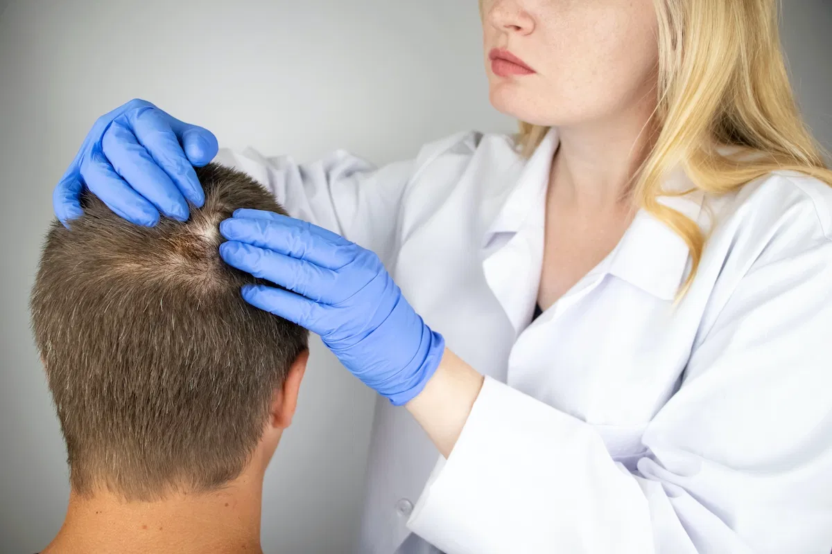 نتائج حقن Jak inhibitors للثعلبة