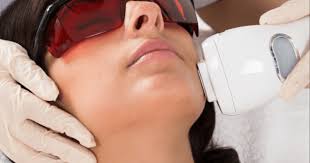 إزالة الشعر بالليزر للمراهقات