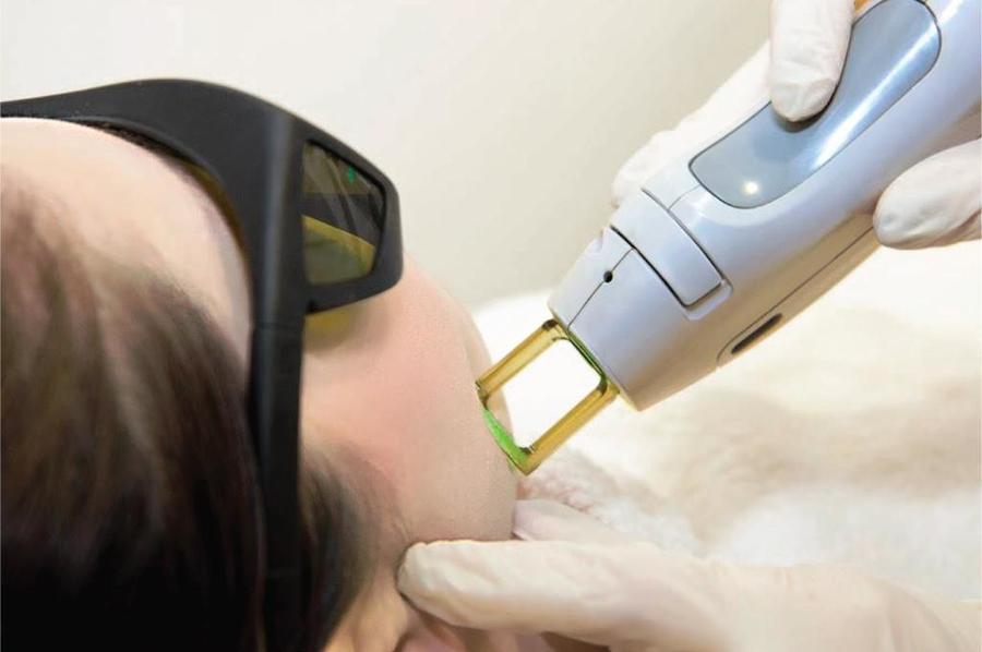 الفرق بين ليزر IPL والليزر الطبي