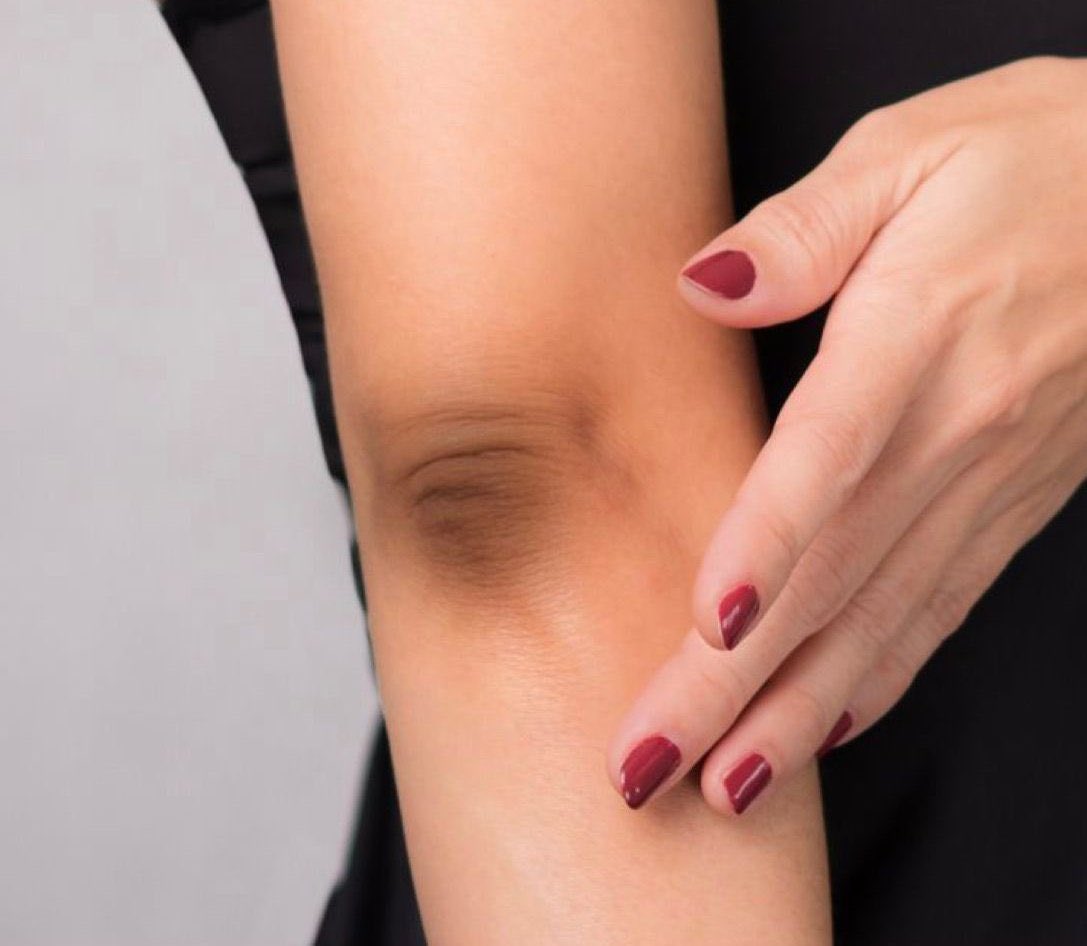 علاج اسمرار الكوع