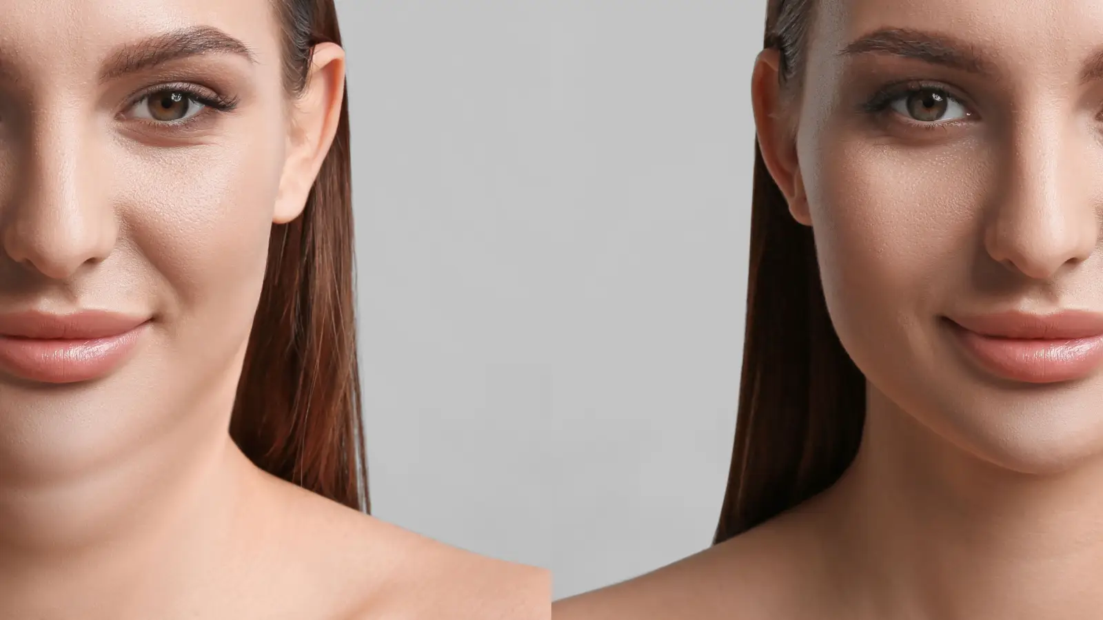 علاج الذقن المزدوج