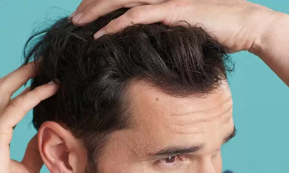 علاج تساقط الشعر عند الرجال