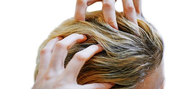 علاج حكة فروة الرأس