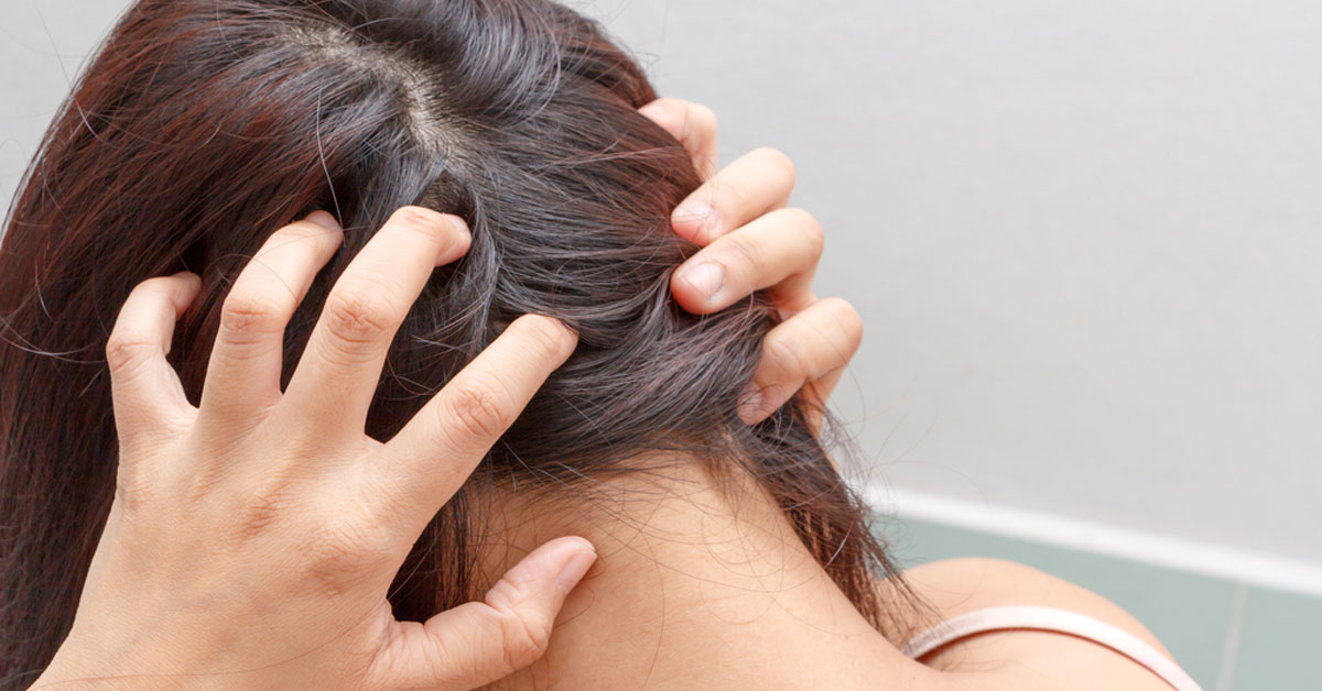 علاج حكة فروة الرأس