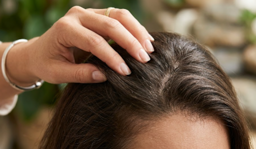 علاج ضعف بصيلات الشعر