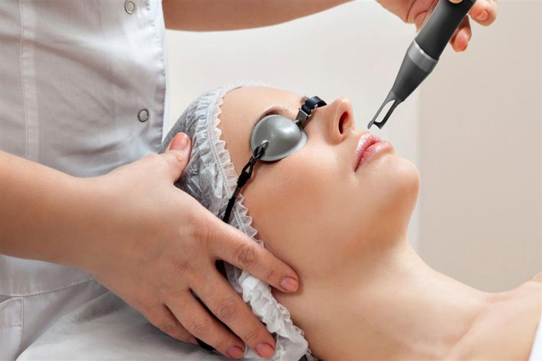 ليزر إزالة شعر الذقن